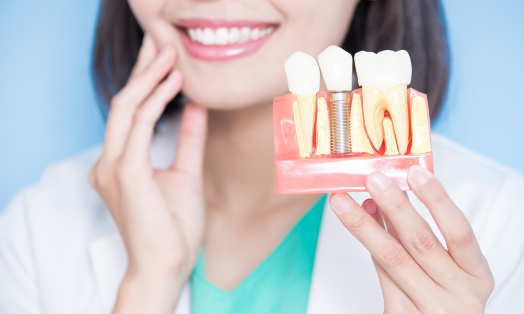 All-on-4 Dental Implants in Nottingham: A Life-Changing Decision