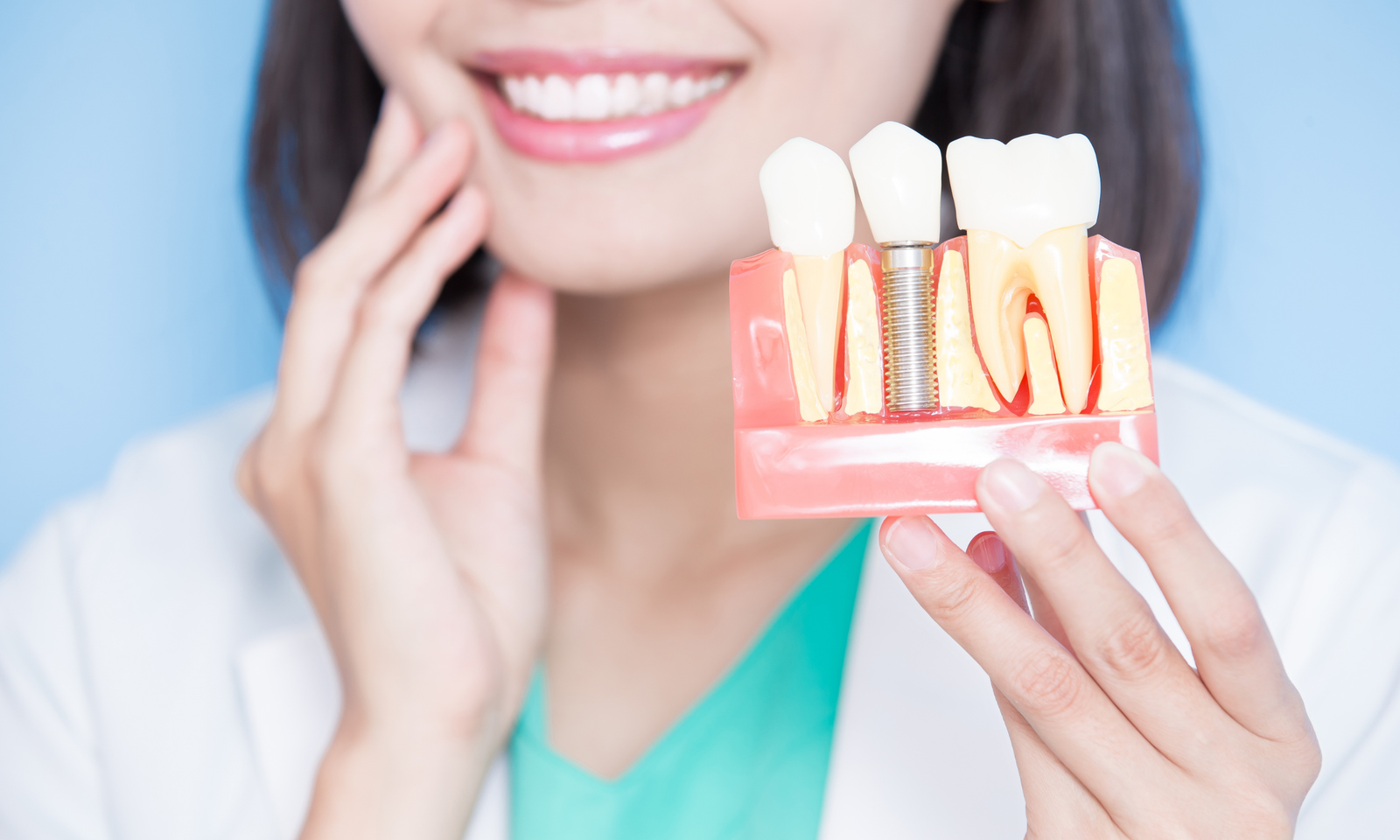 All-on-4 Dental Implants in Nottingham: A Life-Changing Decision