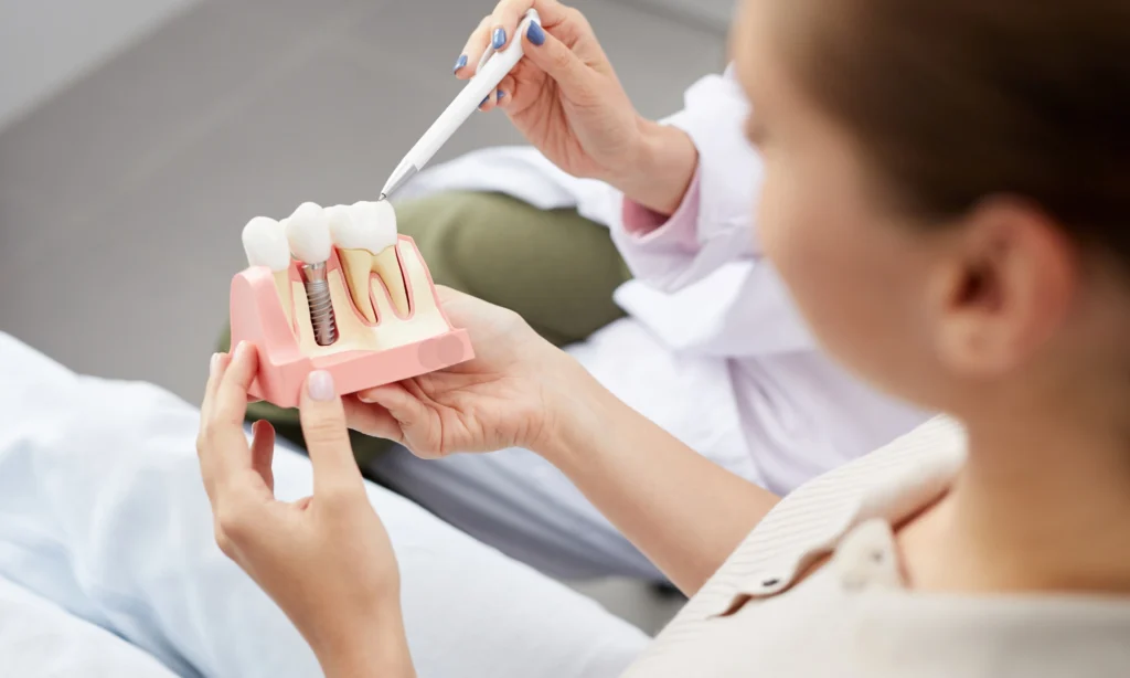 Dental Implants in Keyworth: Replacing Missing Teeth in South Nottinghamshire
