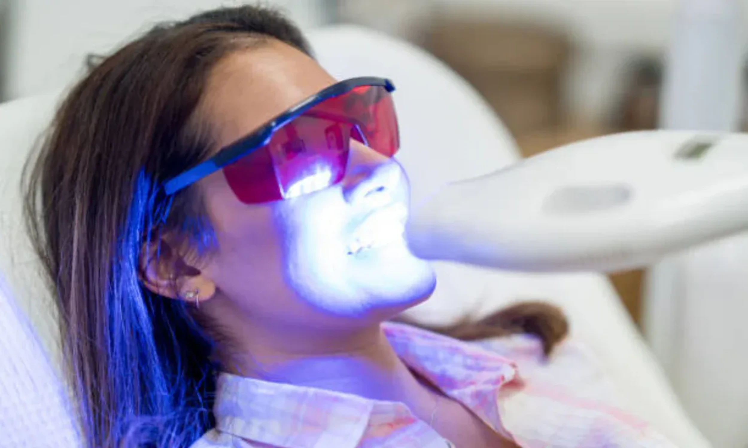 Professional Teeth Whitening at Treeline Dental Suite